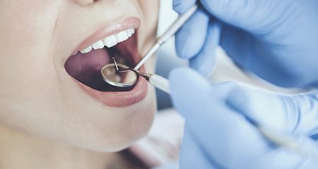 Dentist checking teeth