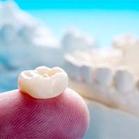 Dental crown in Bellevue on dentist’s fingertip