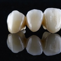 three-part dental bridge in front of a black background