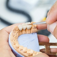 dentist in Bellevue designing a dental bridge