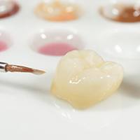 A dental crown.