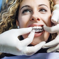 Dentist placing Invisalign in Bellevue on patient