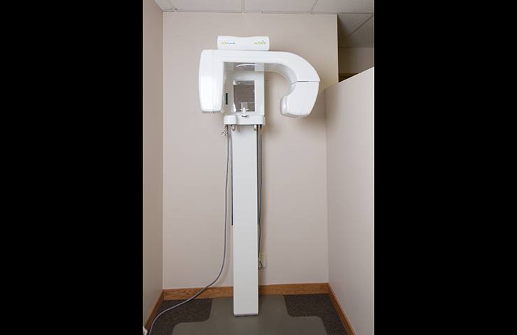 3D cone beam scanner