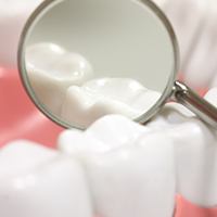 Closeup of teeth with dental sealants