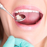 Closeup of smile during dental exam