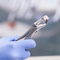 Gloved hand holding extracted tooth in forceps