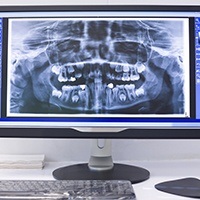 Digital dental x-rays on computer screen